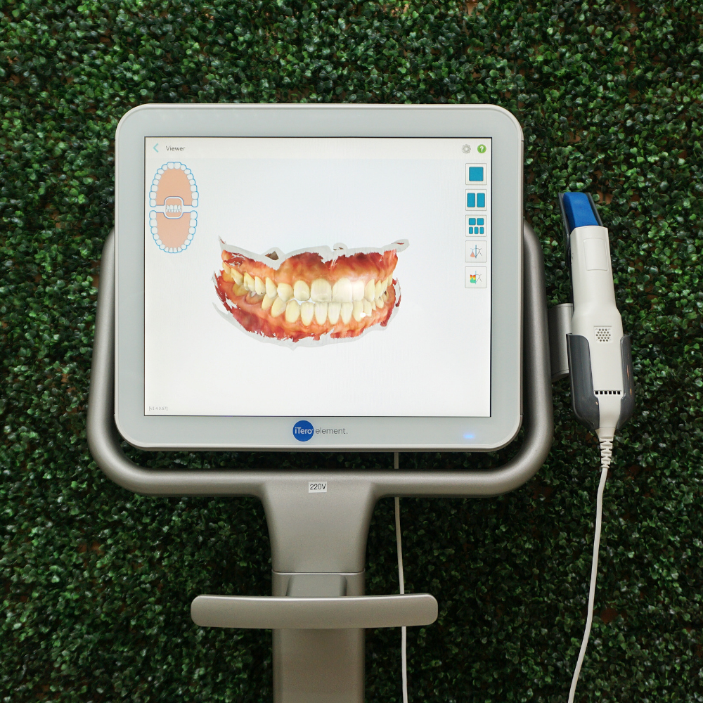 intraoral scanner