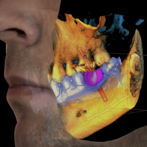 CBCT 2